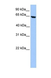 NBP1-54378 - ACADVL