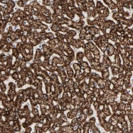 NBP1-89285 - ACAT1 / MAT
