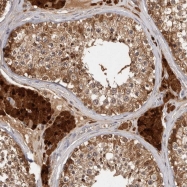 NBP1-89525 - ACAT2 / ACTL