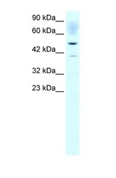 NBP1-54616 - ACAT2 / ACTL