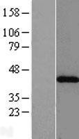 NBL1-07225 - ACAT2 Lysate