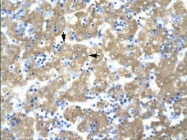 NBP1-54616 - ACAT2 / ACTL