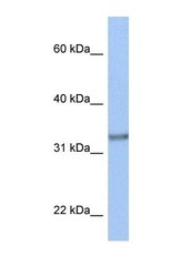 NBP1-59830 - ACBD4