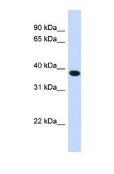 NBP1-59995 - ACBD4