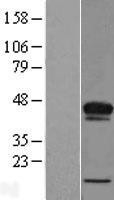 NBL1-07227 - ACBD4 Lysate