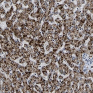 NBP1-85146 - ACBD5