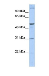 NBP1-59820 - ACBD5
