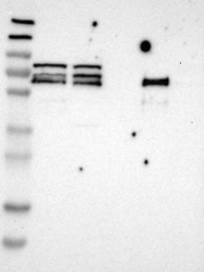 NBP1-85145 - ACBD5
