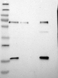 NBP1-85146 - ACBD5