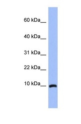 NBP1-56527 - ACBD7