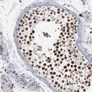 NBP1-90270 - TNK2 / ACK1