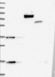 NBP1-90822 - TNK2 / ACK1