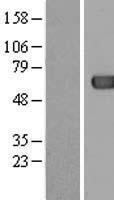 NBL1-07247 - ACOT12 Lysate