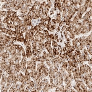 NBP1-80949 - ACOX1