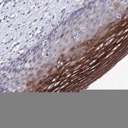NBP1-85900 - ACOX3