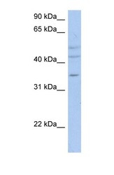 NBP1-59507 - ACPL2