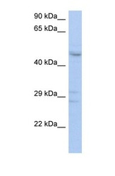 NBP1-59508 - ACPL2