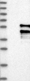 NBP1-83577 - ACPL2