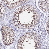NBP1-91648 - ACTL6B
