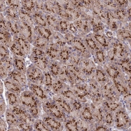 NBP1-93438 - ADAMTSL5