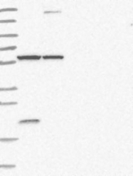 NBP1-82878 - Arginine decarboxylase / ADC