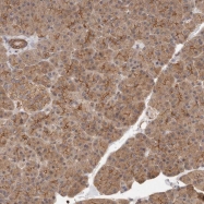 NBP1-90218 - MLLT4 / AF6 / Afadin