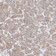 NBP1-90219 - MLLT4 / AF6 / Afadin