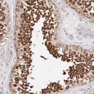 NBP1-90221 - MLLT4 / AF6 / Afadin
