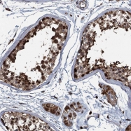 NBP1-83674 - TMEM195