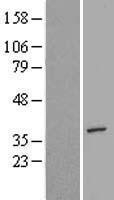 NBL1-12113 - AIMP2 Lysate