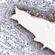 NBP1-89166 - AKAP9