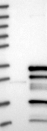NBP1-90202 - AURKAIP1
