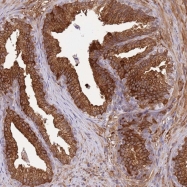 NBP1-91657 - ALDH1A3 / ALDH6