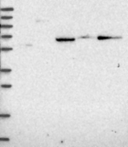 NBP1-91657 - ALDH1A3 / ALDH6