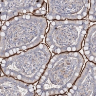 NBP1-81238 - ALKBH8