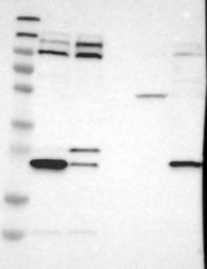 NBP1-90182 - TRAK2 / ALS2CR3