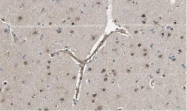 26190002 - AMBRA1