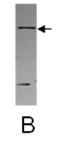 26190002 - AMBRA1