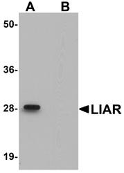 NBP1-77051 - ANKRD54 / LIAR
