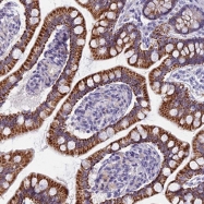 NBP1-89056 - AP4 complex subunit epsilon-1