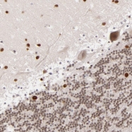 NBP1-93894 - ARHGAP36
