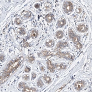 NBP1-90104 - DIRAS3