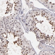 NBP1-90277 - ACAM / ASAM