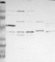 NBP1-90277 - ACAM / ASAM