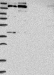 NBP1-90086 - ASCC3L1