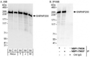 NBP1-79036 - ASCC3L1
