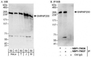 NBP1-79037 - ASCC3L1
