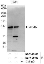 NBP1-79015 - ATMIN / ZNF822