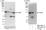 NBP1-79016 - ATMIN / ZNF822