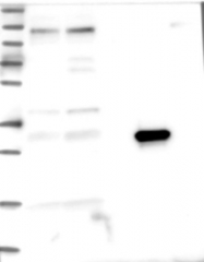 NBP1-85832 - ASPDH